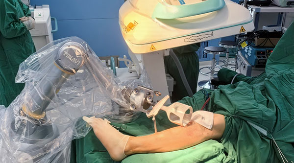 智汇天玑 | 海淀医院骨科运用TINAVI手术机器人系统顺利完成胫骨高位截骨手术